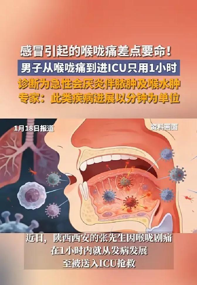 河南确诊病例-河南确诊病例以为是感冒 愧对家乡人民-第2张图片