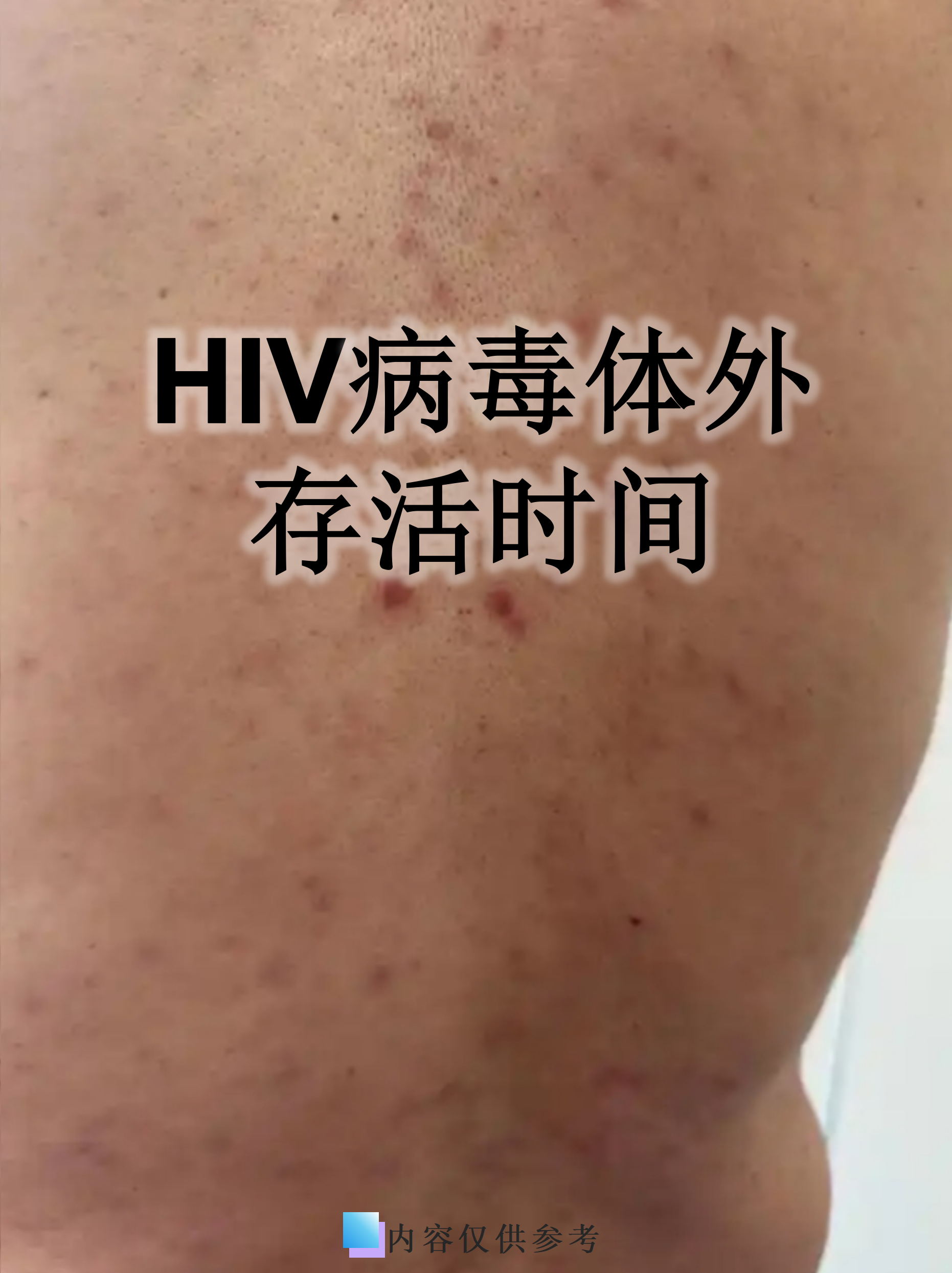 “江苏新增无症状感染者13例” 江苏新增无症状感染者13例？-第2张图片