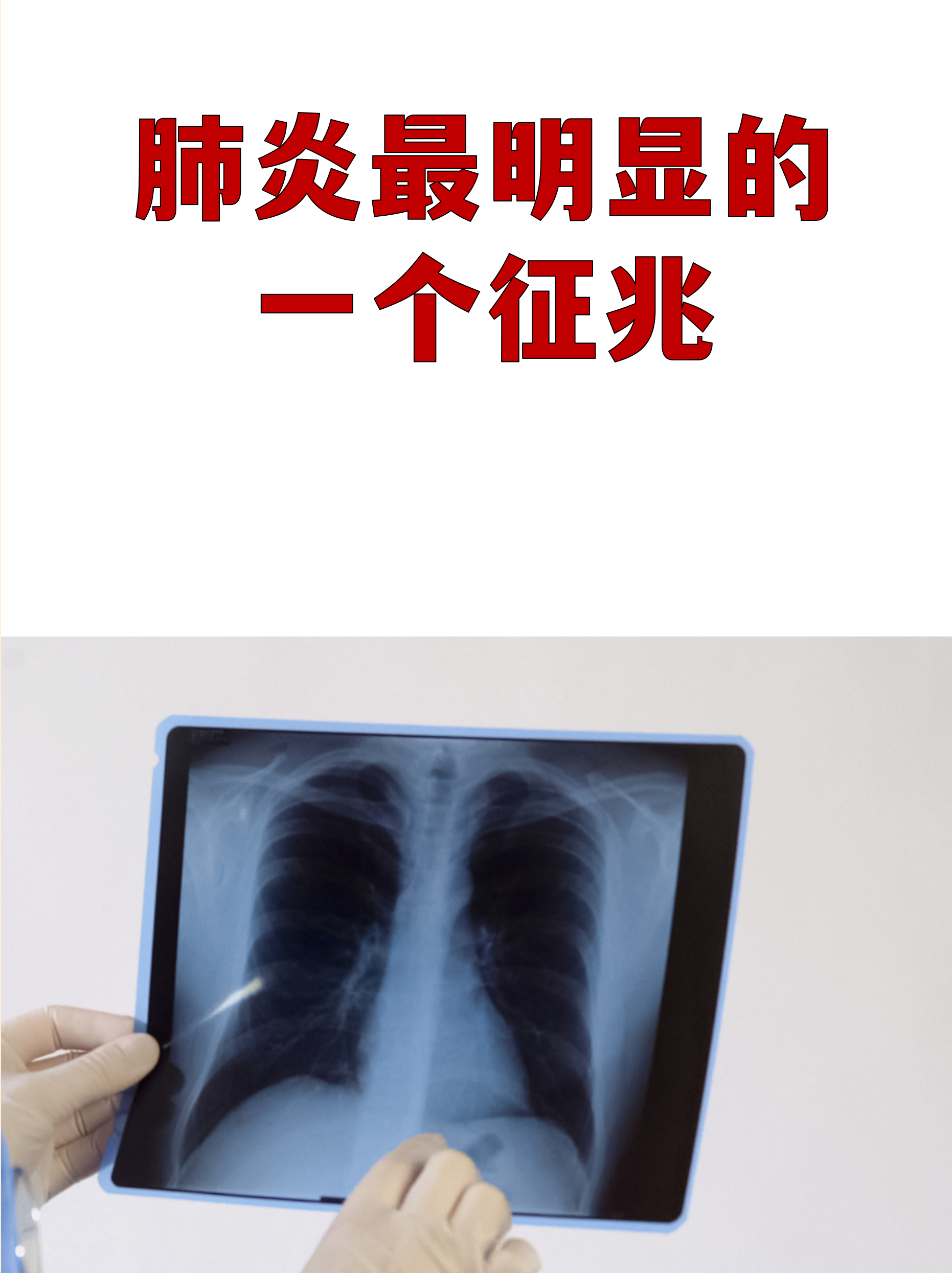 黑龙江肺炎最新消息,黑龙江最新情况-第3张图片